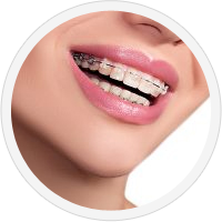 charles town orthodontist for braces