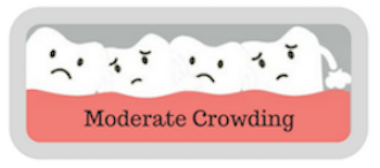 moderate-crowding-quiz
