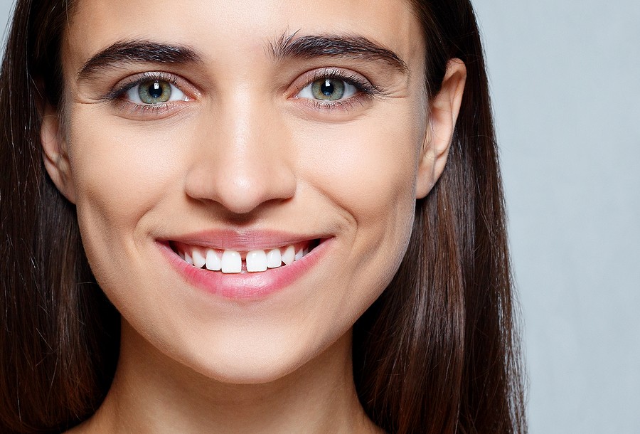 Orthodontist in Martinsburg, WV: Can Braces Fix Gaps?